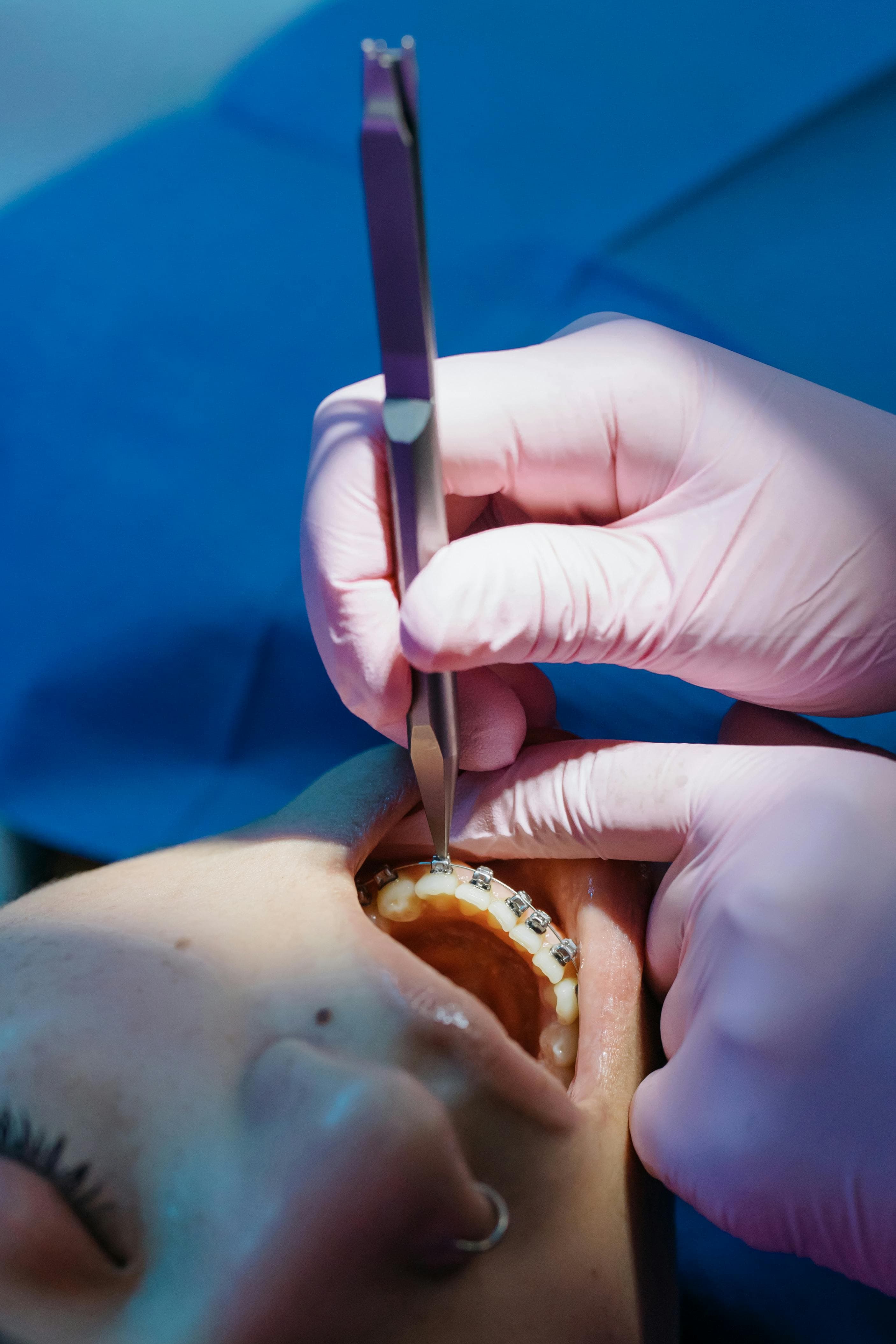 Orthodontics